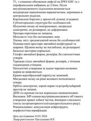 kachan-istoriya-bolezni-foto-2