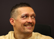 ФОТО. Усику наложили четыре шва над глазом, чтобы остановить рассечение фото 2 foto-usiku-nalozhili-chetyre-shva-nad-glazom-chtoby-ostanovit-rassechenie-foto-2