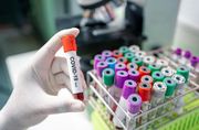 ООН: Пандемия коронавируса — самый большой вызов со времен Второй мировой
