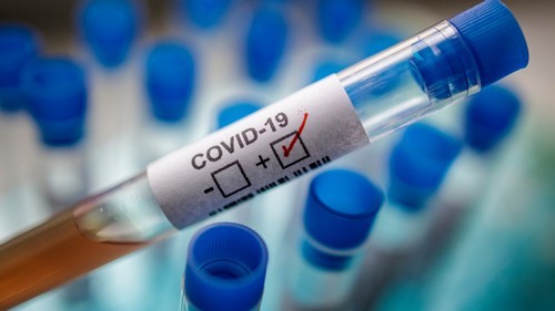 В Украине выросло количество зараженных коронавирусной инфекцией COVID-19