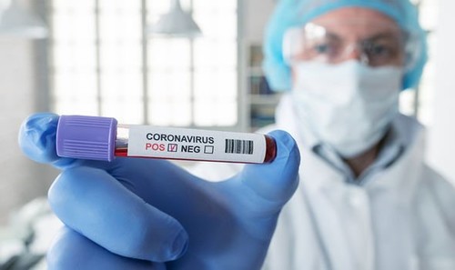В Украине за сутки 308 новых случаев заражения коронавирусом