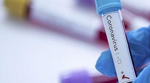 В Україні зафіксовано 325 нових випадків зараження коронавірусом