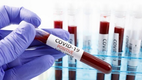 В Украине уже более 10 тысяч зараженных коронавирусом