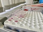 Стало известно, сколько команды платят за одно ПЦР-тестирование
