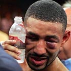 Еще одного Кастильо побили!