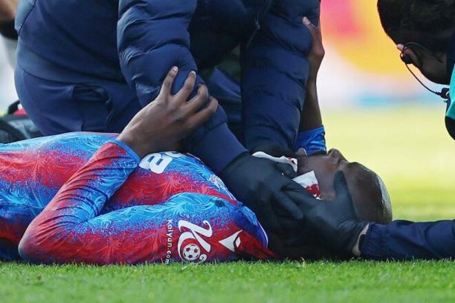 Прыжок шипами в голову. Ужасный эпизод из Кубка Англии: каковы последствия