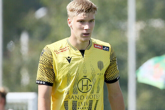 Півзахисник Руха уникнув перелома носа