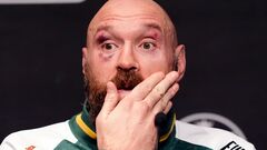 Al-Sheikh told what problems Fury faced after the fight with Usyk