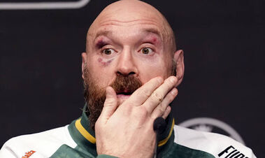 ФОТО. Як виглядає Тайсон Ф'юрі після завершення кар'єри і поразки Усику