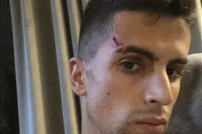 ФОТО. Звездный футболист полез в драку в ночном клубе