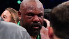 Derek Chisora: