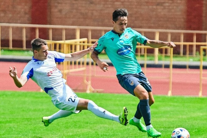 Травма на тренуванні. Перелом та гіпс: підопічний Ковальця надовго вибув