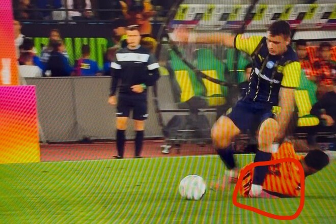 Источник: травму Гаджиева нужно оперировать, 3 месяца вне поля