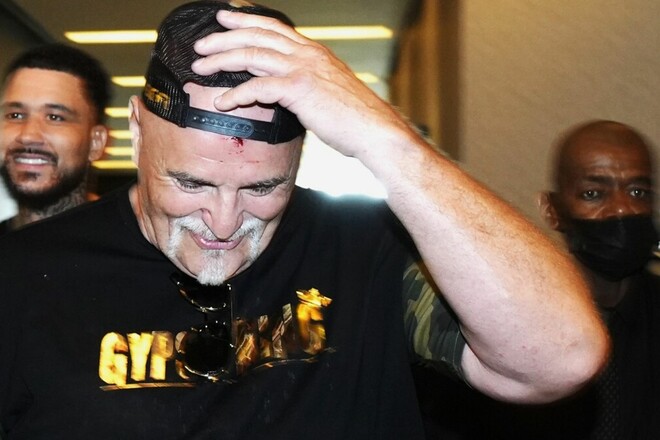 «Ему конец». Фьюри назвал победителя реванша Усик – Дюбуа