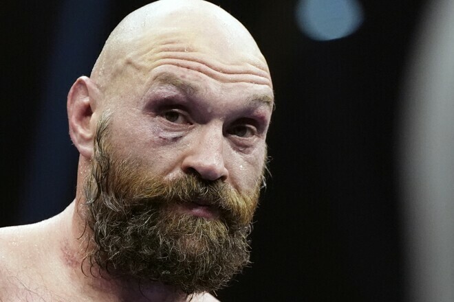 Fury has already promised a title battle. Is the incentive to return to boxing