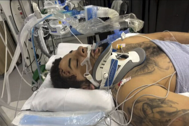 ФОТО. Футболист АПЛ потерял ногу после аварии. Страшная трагедия