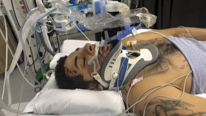 ФОТО. Футболіст АПЛ втратив ногу після аварії. Жахлива трагедія