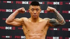 Ukrainian boxer underwent emergency surgery: 