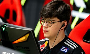 «Зараз все добре». Снайпер FURIA прокоментував проблеми з оком