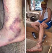 Тайсон Фьюри против Владимира Кличко. Кто кому «гондурас»?