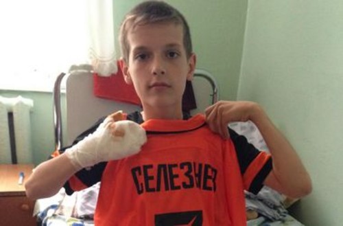 Селезнев оплатил лечение 12-летнему мальчику