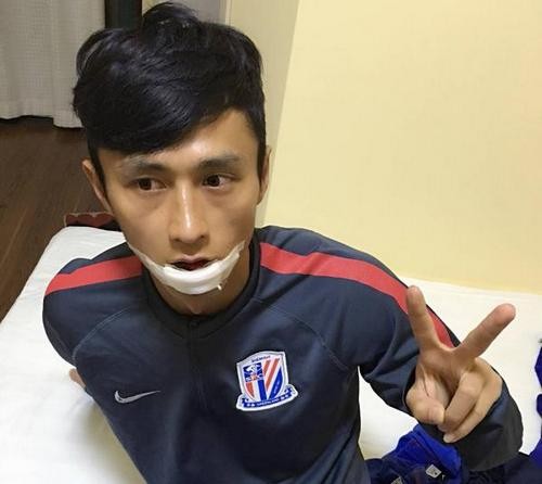 Китайский футболист ударом ноги нокаутировал одноклубника