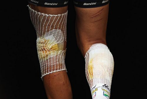 ФОТО ДНЯ. Что происходит с ногами велосипедистов на Tour de France